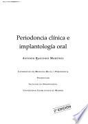 libro Periodoncia Clínica E Implantación Oral